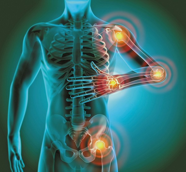 How to Naturally Reduce Inflammation